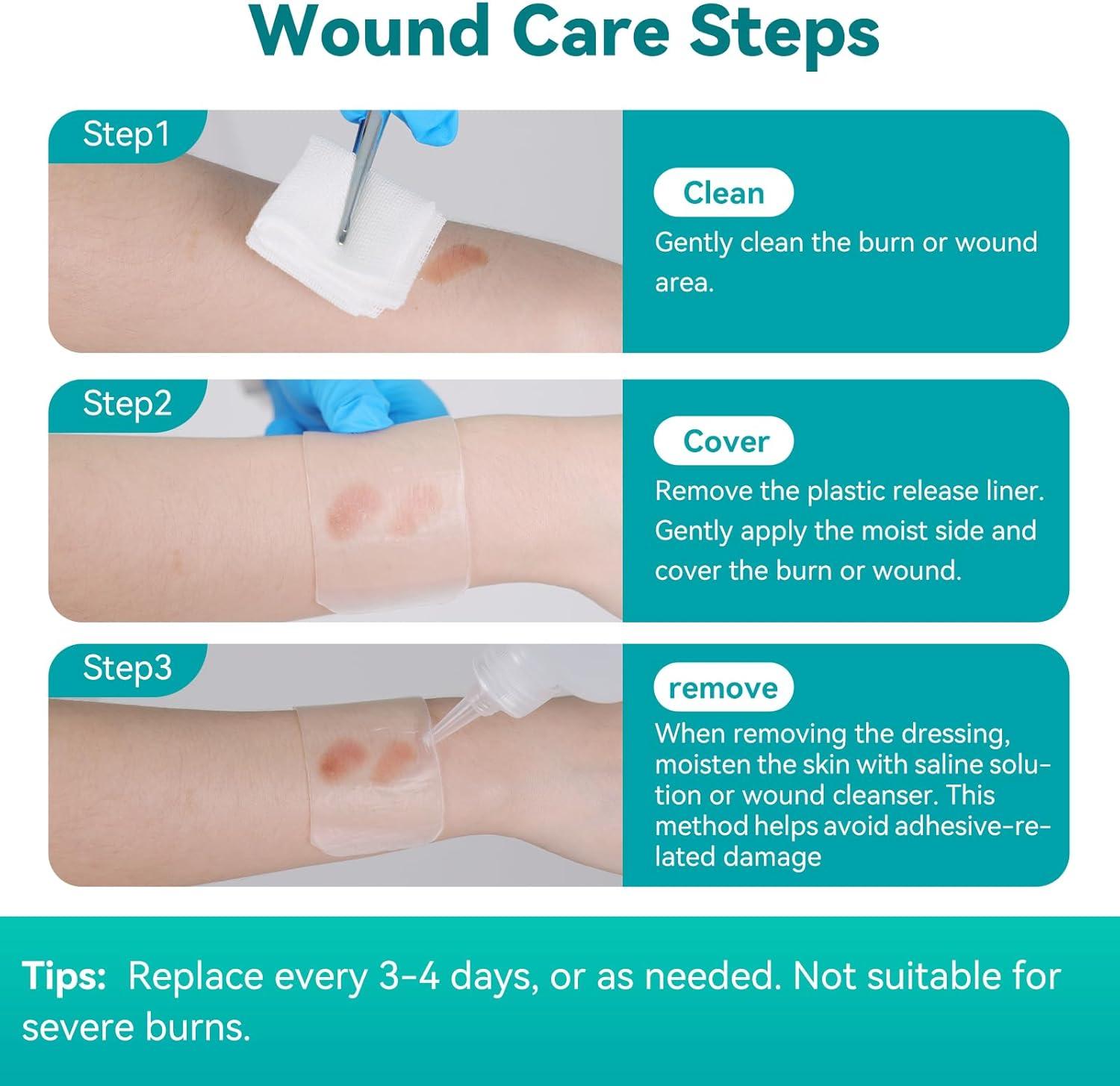 imageDimora Hydrogel Wound Dressing 17quot x3quot  Burn Pads Sterile Soothing Bandage Cooling Protective Treatment for Minor Burns ampamp Blisters Cuts AbrasionsCracked Nipples 10 Count17 x310 Count