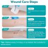 imageDimora Hydrogel Wound Dressing 17quot x3quot  Burn Pads Sterile Soothing Bandage Cooling Protective Treatment for Minor Burns ampamp Blisters Cuts AbrasionsCracked Nipples 10 Count17 x310 Count