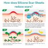 imageDimora Medical Grade Silicone Scar Sheets  Ultra Soft Silicone Scar Tape 16x120quot Roll Waterproof Scar Treatment for Surgical Scars C Section Tummy Tuck Keloid Treatmentscar sheet120