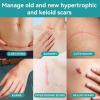 imageDimora Silicone Scar Gel  Scar Cream for Surgical Scars Keloid BumpStretch Marks RemovalAcne Scar Treatment and Csection Recovery 106 oz 30g 2Pack