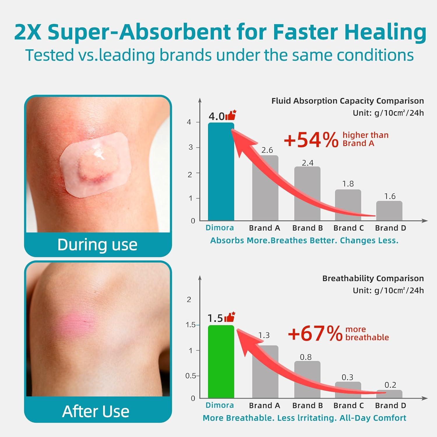 imageDimora Medical Grade Hydrocolloid Roll 2in16ft Highly Absorbent Hydrocolloid Bandages for Wound Care Burn Blister Acne Care Waterproof ampamp Cut to Size