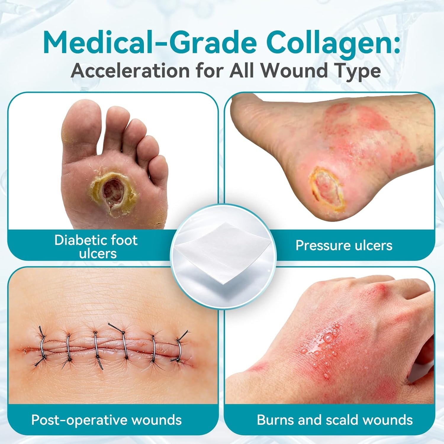 image:imageDimora Collagen Wound Dressing 100 Bovine Type I Collagen Sponge High Absorbency 4X Fluid Biodegradable for Chronic amp Acute Wounds Promotes Faster Healing 2X2 5PCS2210PCS