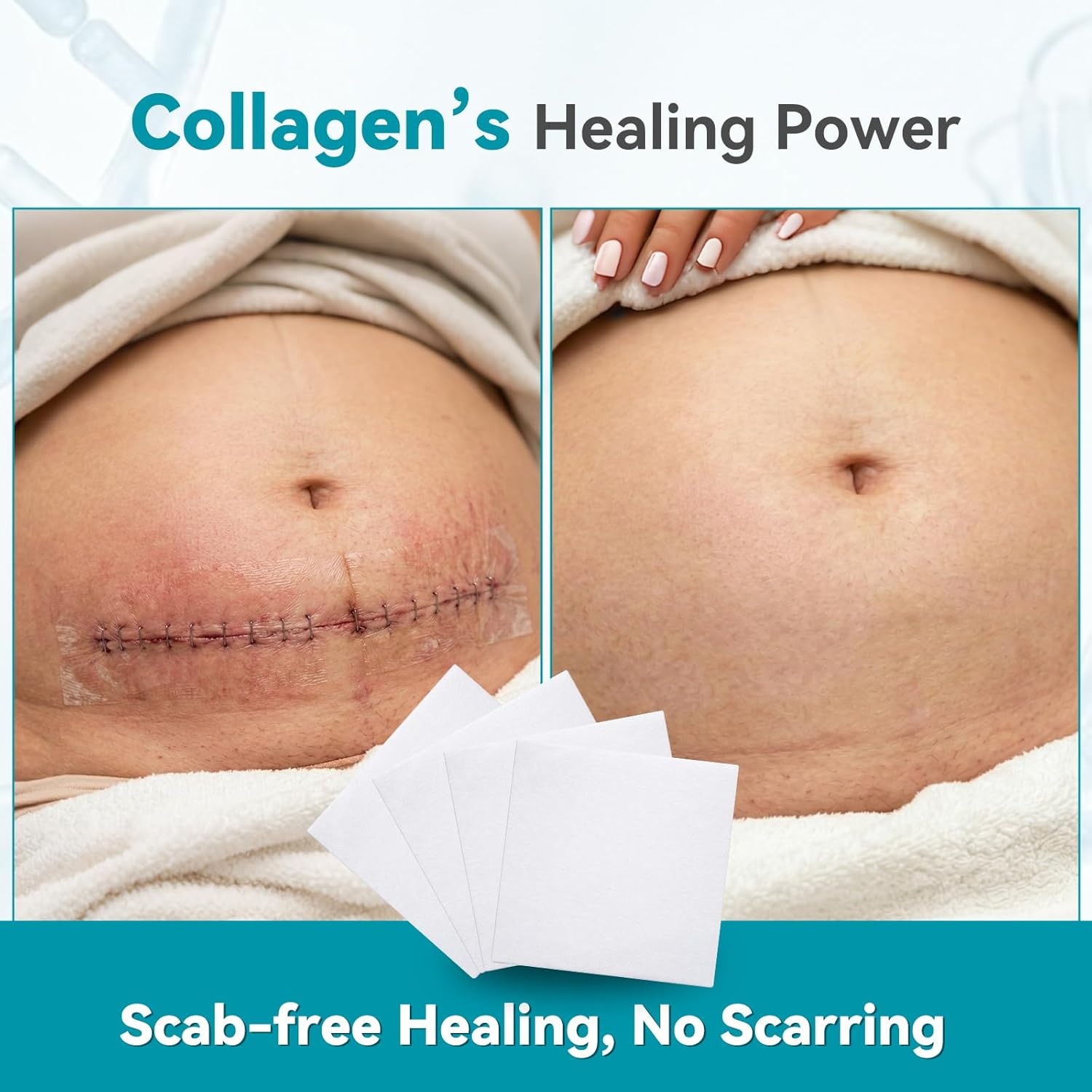 image:imageDimora Collagen Wound Dressing 100 Bovine Type I Collagen Sponge High Absorbency 4X Fluid Biodegradable for Chronic amp Acute Wounds Promotes Faster Healing 2X2 5PCS2210PCS