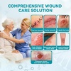 image:imageDimora Calcium Alginate Wound DressingampDimora Silicone Super Absorbent Wound Dressings