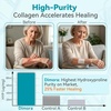 image:imageDimora Collagen Wound Dressing 100 Bovine Type I Collagen Sponge High Absorbency 4X Fluid Biodegradable for Chronic amp Acute Wounds Promotes Faster Healing 2X2 5PCS445PCS