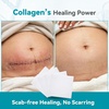 image:imageDimora Collagen Wound Dressing 100 Bovine Type I Collagen Sponge High Absorbency 4X Fluid Biodegradable for Chronic amp Acute Wounds Promotes Faster Healing 2X2 5PCS225PCS