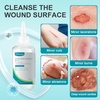 image:imageDimora Skin and Wound Cleanser  Silicone Super Absorbent Wound Dressing