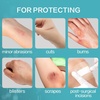 image:imageDimora Foam Wound Dressing 2x5 5 Pack  Waterproof Transparent Film Dressing with Pad 50 Pack 23x27