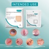 image:image10 Pack Hydrocolloid Bandages 2x4 5 Packs Ag Silicone Foam Dressing 4 x 425 X 25 pad Adhesive Waterproof Wound Dressing High Absorbency Fast Healing