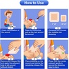 image:image5 Packs Silicone Foam Dressing 4x4 25x25 pad 5 Packs Silver Foam Dressing with Adhesive BorderUltra Absorbent Waterproof Wound Dressing