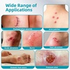 image:imageDimora 20 Pack Hydrocolloid Wound Dressing amp Medical Grade Hydrocolloid Roll