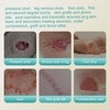 image:imageDimora Fenestrated Foam DressingDimora Silicone Foam Dressing Without Border