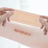 image:imageDimora Foam Wound Dressing 2x5 5 Pack  Waterproof Transparent Film Dressing 50 Packs