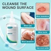 image:imageDimora Wound Dressing Sacrum Foam Bandages Silicone Adhesive Border and Dimora Skin and Wound Cleanser OTC First Aid Antiseptic Cleanser