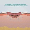 image:imageFill and Protect Wound Cavity Prevent Pressure harm
