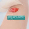 image:imageFill and Protect Wound Cavity Prevent Pressure harm