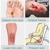 image:imageFill and Protect Wound Cavity Prevent Pressure harm