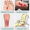 image:imageSilicone Adhesive Foam Dressing Without Border amp Calcium Alginate Wound Dressing
