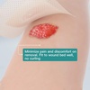image:imagefrom serious Chronic Wound to Total Healing