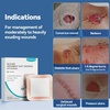image:imageDimora Sacrum Silicone Absorbent Wound Dressing with Border 7 x 7 Sacral Dressing for Bed Sores Pressure Sore Large Bandage with Gentle Adhesive for Moderate to Heavy Exudate 10 Count5x 5