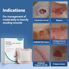 image:imageDimora Sacrum Silicone Absorbent Wound Dressing with Border 7 x 7 Sacral Dressing for Bed Sores Pressure Sore Large Bandage with Gentle Adhesive for Moderate to Heavy Exudate 10 Count5x 5  20 pcs