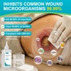 image:imageDimora Portable First Aid Wound Wash Solution OTC Skin and Wound Cleanser for Cuts Abrasions Lacerations Burns SkinNeutral pH  3Pack Travel Size 60mL Each 6oz Total296ml