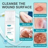 image:imageDimora Portable First Aid Wound Wash Solution OTC Skin and Wound Cleanser for Cuts Abrasions Lacerations Burns SkinNeutral pH  3Pack Travel Size 60mL Each 6oz Total296ml