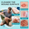 image:imageDimora Portable First Aid Wound Wash Solution OTC Skin and Wound Cleanser for Cuts Abrasions Lacerations Burns SkinNeutral pH  3Pack Travel Size 60mL Each 6oz Total60ml3