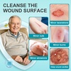 image:imageDimora Portable First Aid Wound Wash Solution OTC Skin and Wound Cleanser for Cuts Abrasions Lacerations Burns SkinNeutral pH  3Pack Travel Size 60mL Each 6oz Total237ml2